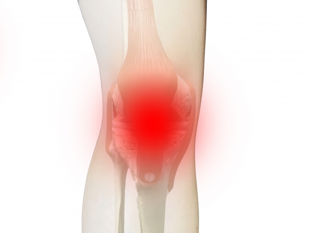 膝の痛みの正体