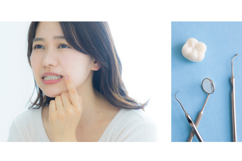 虫歯だらけの歯は歯列矯正できるのか？虫歯と歯列矯正の関係