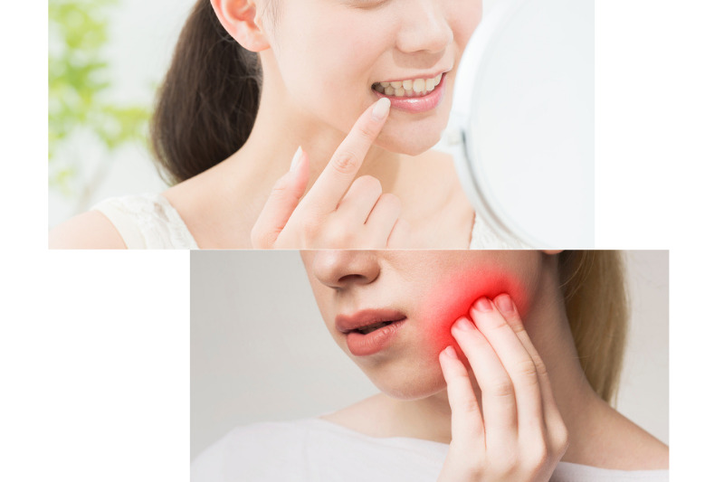詰め物をした歯が痛いのはなぜ？その原因と対処法