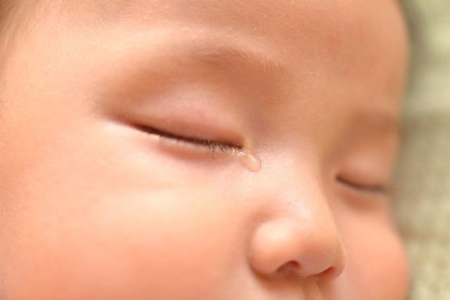 赤ちゃんの目ヤニ、涙が止まらない「先天性鼻涙管閉塞」 原因・治療法・注意点を解説