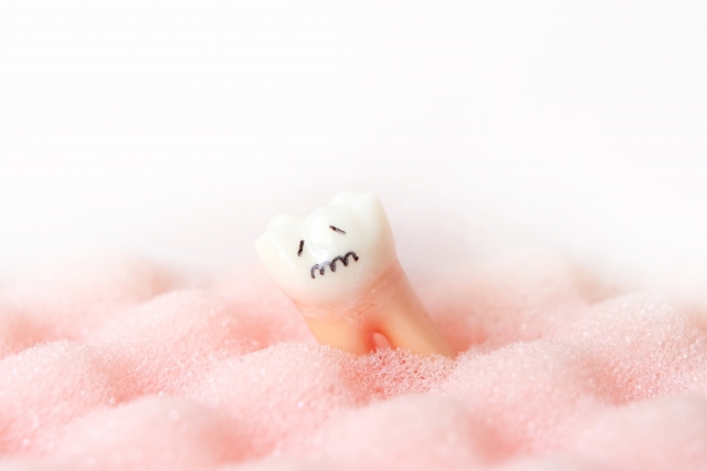 歯周病原細菌が早産に関係する？