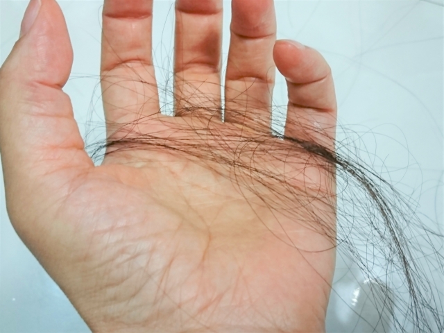 円形脱毛症の原因とほかの病気との関連