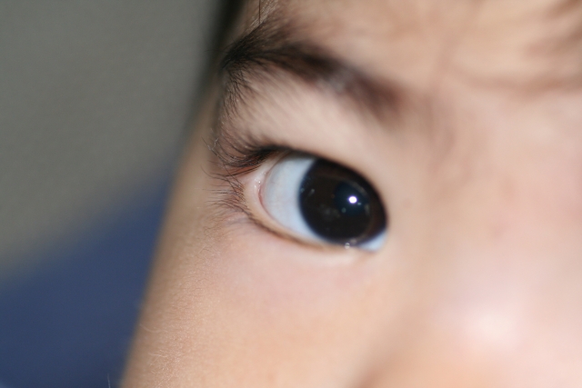 子どもの近視を予防。さまざまな検査でチェックして進行を抑える