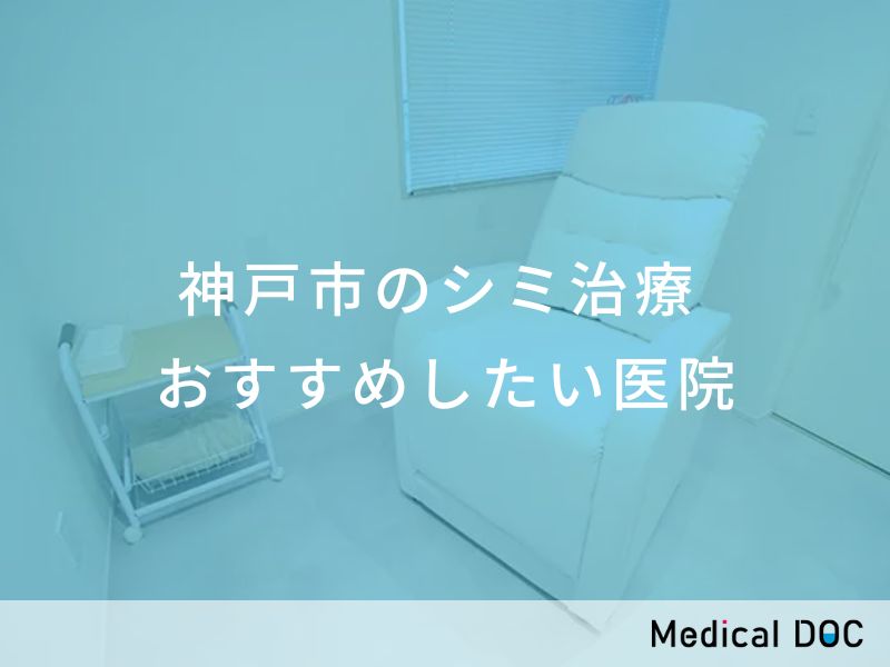 神戸市のシミ治療　おすすめしたい医院