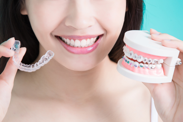 矯正すべき歯並び、しなくてもいい歯並びの違いはあるのか？