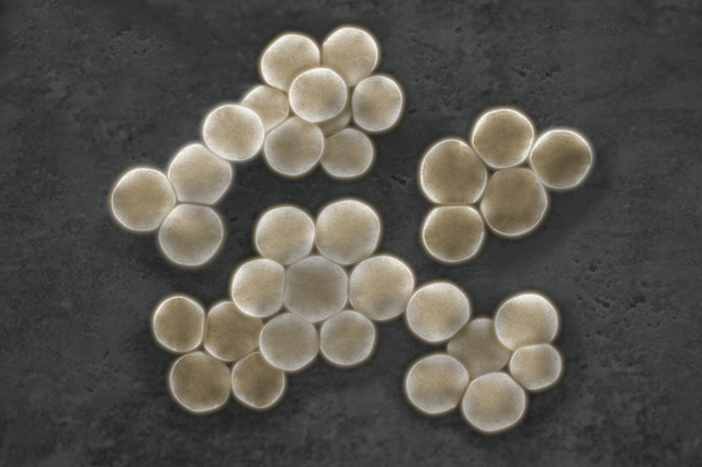 黄色ブドウ球菌が薬剤耐性獲得して伝番する仕組み解明