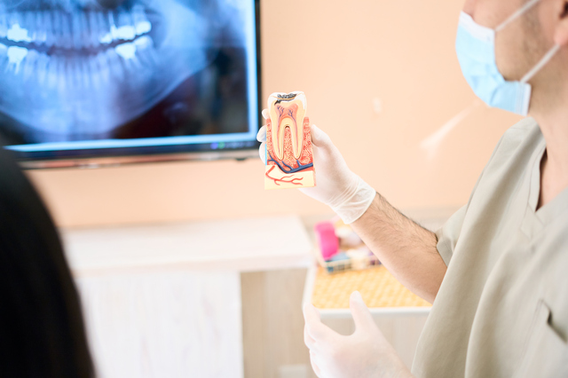 「根管治療で歯を残す or 抜歯」、その境目をどう見分ければいいのか