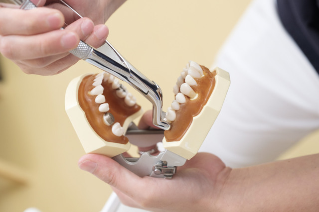 根管治療と抜歯の違い