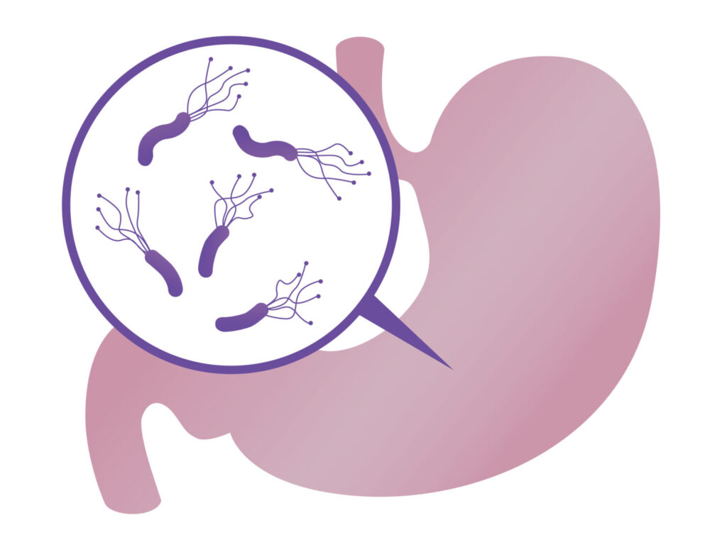 胃の中のピロリ菌のイメージ
