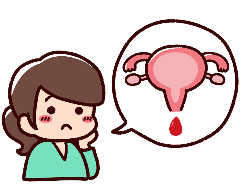子宮頸管ポリープの症状