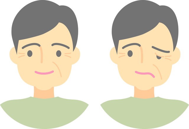 「ハント症候群（顔が動かせない・めまい・耳が痛む病気）」の原因・治療期間はご存知ですか？