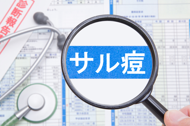 サル痘の日本での感染4人目を確認