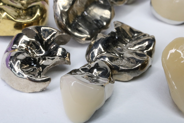 歯の詰め物(インレー)の素材には何がある？ 金属やセラミック、それぞれの特徴は？