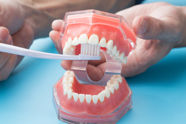 歯医者が教える歯科治療後のセラミックの寿命や長持ちさせる方法