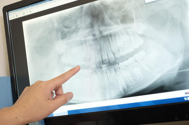 歯列矯正の「後戻り」の原因とは？
