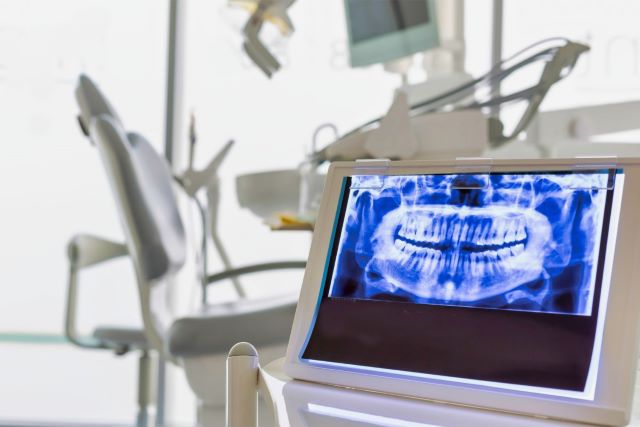 歯科の静脈内鎮静法で気になるリスクと副作用