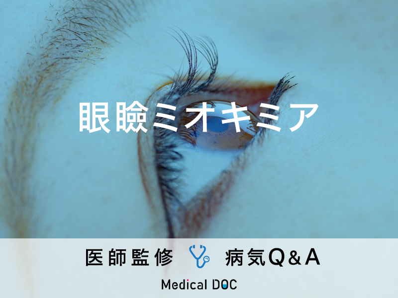 「眼瞼ミオキミア」の症状・原因・予防方法はご存知ですか？医師が監修！