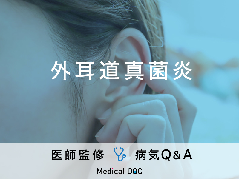 「外耳道真菌炎」を発症すると現れる症状・原因はご存知ですか？医師が監修！