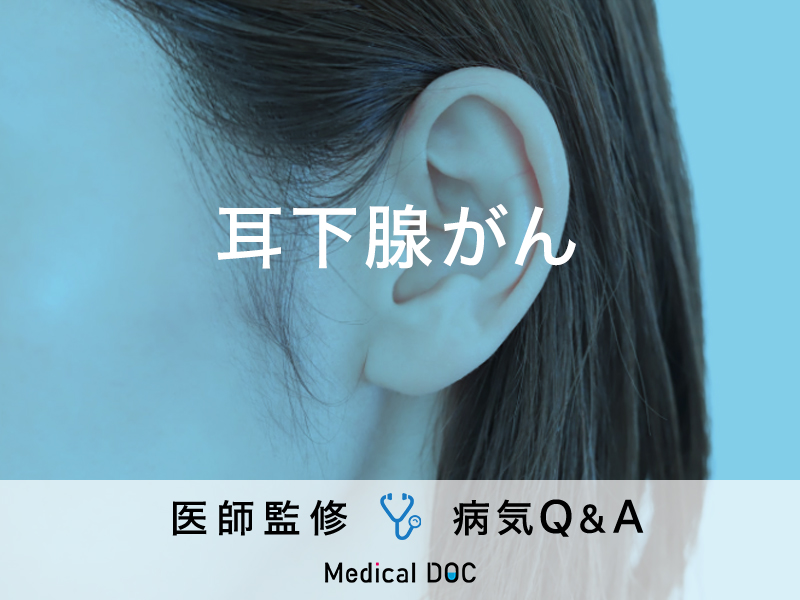 「耳下腺がん」を疑う初期症状・原因はご存知ですか？医師が監修！