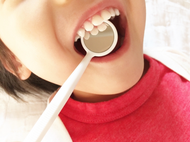 【歯科医師執筆】《永久保存版》歯石を除去する方法！