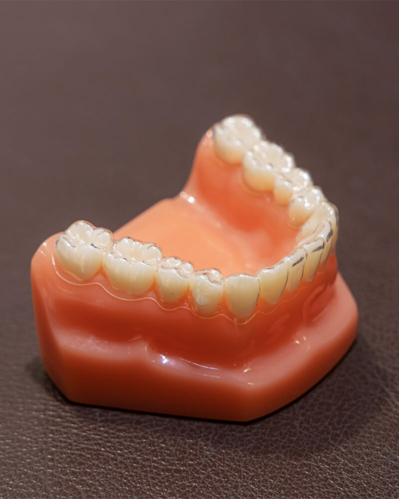 【審美性を向上】歯科医院できれいな歯に整える方法